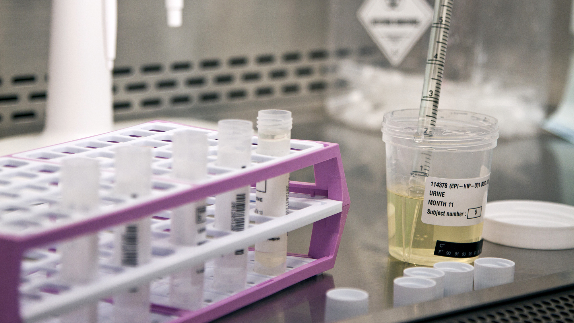 urine drug test kit